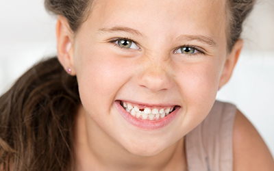 Young girl smiling with a missing tooth