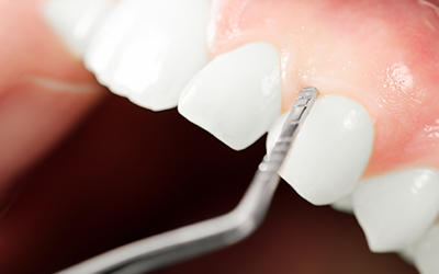 Gum examination