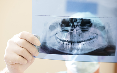 A dentist examining an x-ray