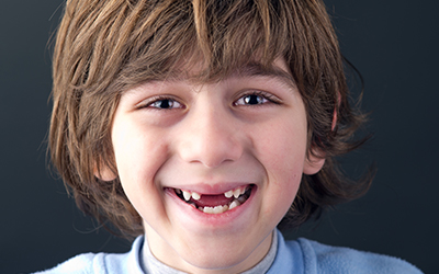 A young boy smiling with missing teeth